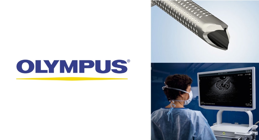 Olympus Launches SecureFlex Single-Use Fine Needle Biopsy Device in U.S.